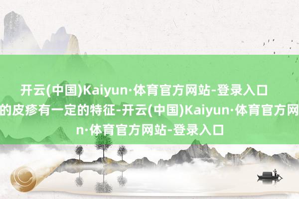 开云(中国)Kaiyun·体育官方网站-登录入口    蚊虫叮咬后的皮疹有一定的特征-开云(中国)Kaiyun·体育官方网站-登录入口